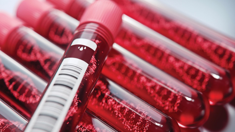 The liquid biopsy market size: Global Industry Trends, Share, Size, Growth, Opportunity and Forecast 2019-2027