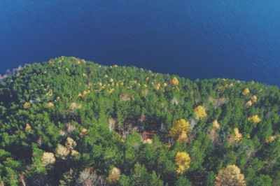 natural transplants hair hair transplantation center and hair restoration treatment near alexandria