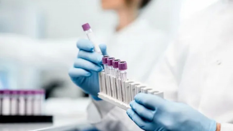 Biobanking Equipment to Advance Product Innovations