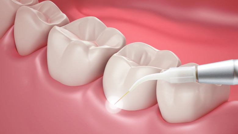 How Can A Gum Recession Diagnose?