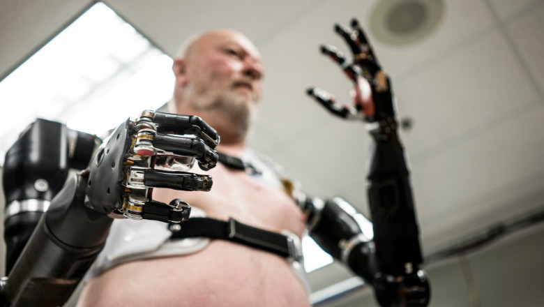 Robotic Prosthetic Market Growth Analysis, Revenue Share by 2029