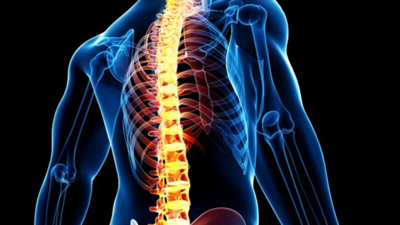 Using Spinal Implants, Two Vertebrae Can Be Mobilized And Abnormalities Can Be Repaired