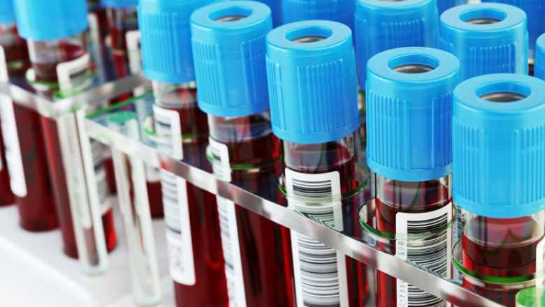 Amylase Testing Market 2022 Key Players, Share & Forecast Report to 2028