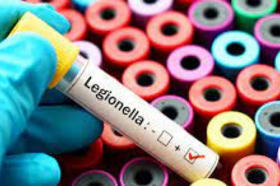 Legionella Testing Market 2022 | Industry Demand, Fastest Growth, Opportunities Analysis and Forecast To 2028