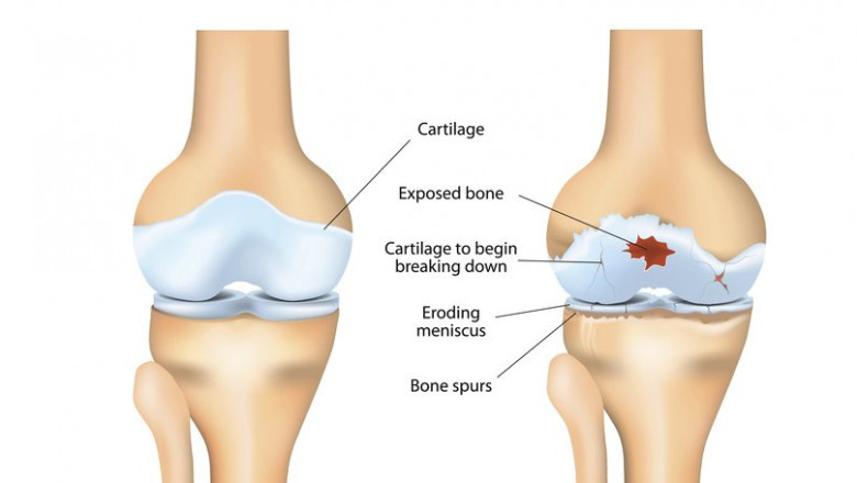 Best Online Homeopathy Doctors in India | Book online Homeopathy Consultation