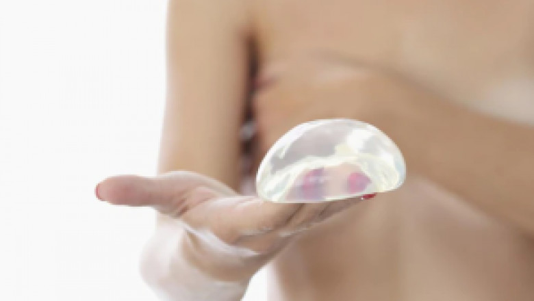 Breast Implant Removal Or Exchange Surgery In Dubai