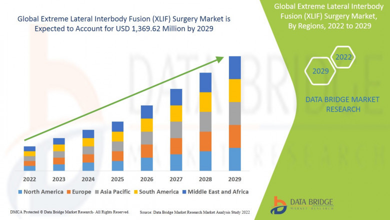 Global Extreme Lateral Interbody Fusion (XLIF) Surgery Market to reach USD 1,369.62 million by 2029