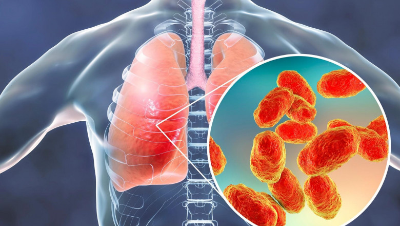 Eucalyptus oil - Unani Medicine For Respiratory Maladies Treat?