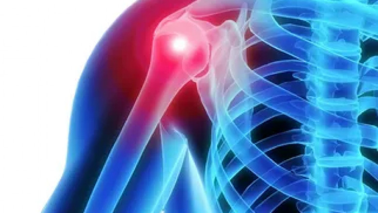 Orthopedic medical imaging to diagnose a medical condition non-invasively by imaging the body's internal structure