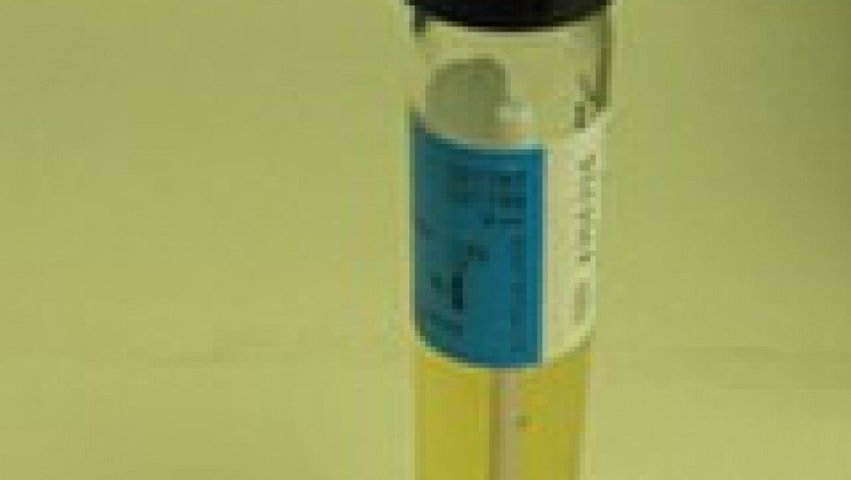 Thioglycolates Market 2022 Size, Dynamics & Forecast Report to 2028