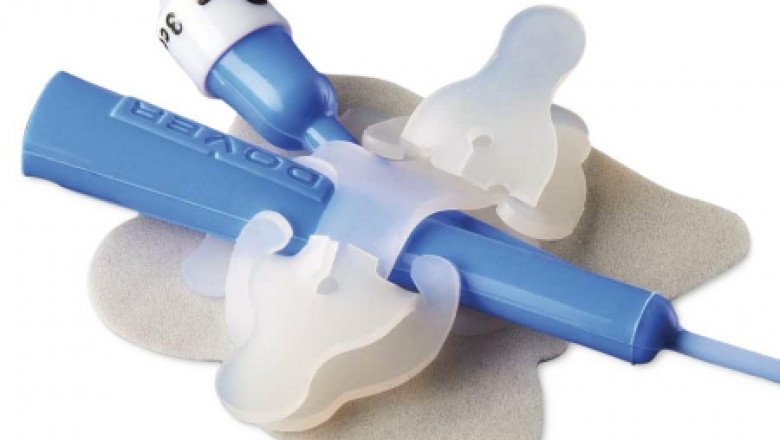 Catheter Stabilization Devices Market 2022 | Industry Demand, Fastest Growth, Opportunities Analysis and Forecast To 2028