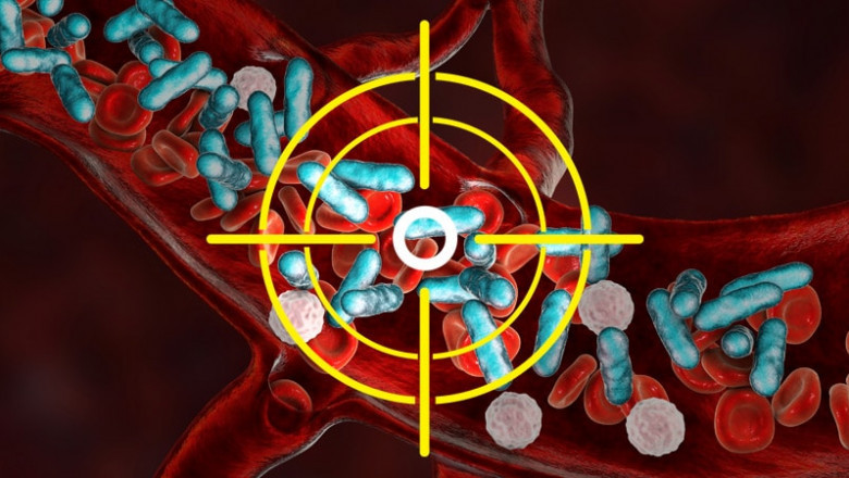 Global Procalcitonin Antibody Market Restraints