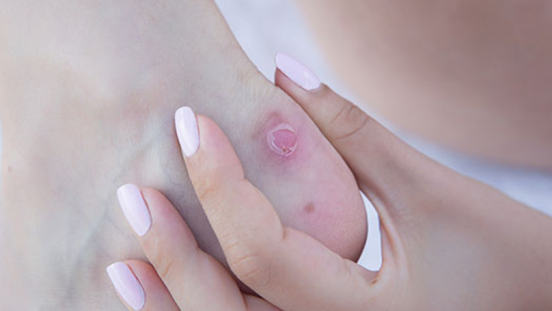 Top Features You Should Look For While Finding The Right Foot Clinic