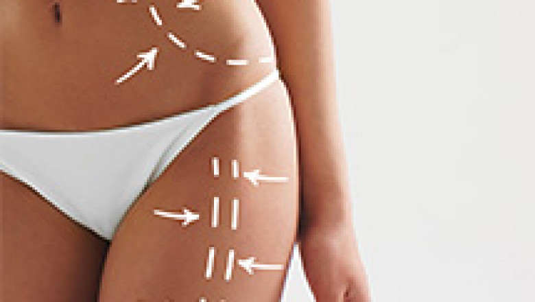 Body Contouring Treatment In Ahmedabad - Non-Surgical Contouring Surgery