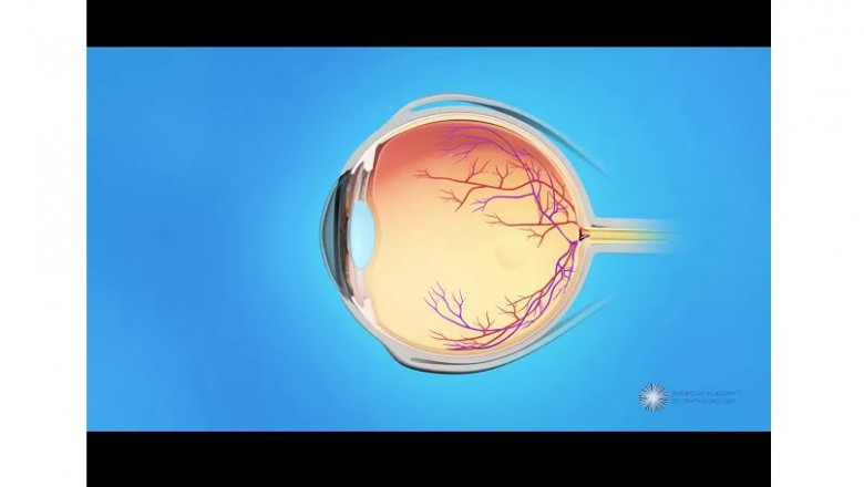 Follow These Tips To Become An Expert In Eye Care