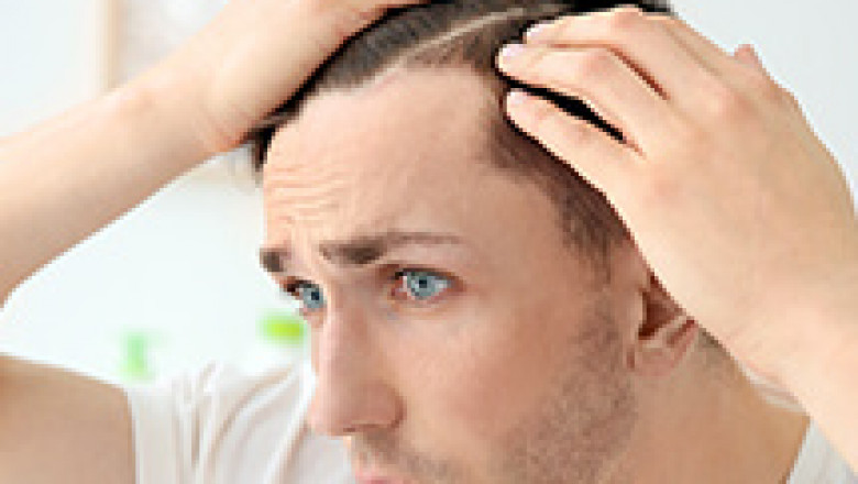 FUT Hair Transplant, Ahmedabad | Musk