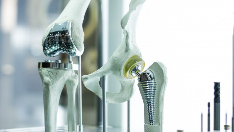 The Maintenance Of Muscular Health Makes Considerable Use Of Orthopaedic Biomaterial