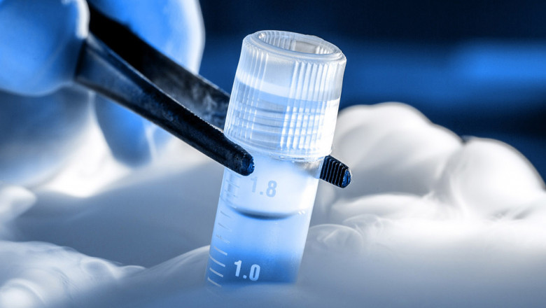 The process of stem cell banking is one of the most widely used ways to treat neurological disorders and cardiovascular diseases.