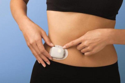 Tubeless Insulin Pump Users Occasionally Encounter Minor Issues With Them