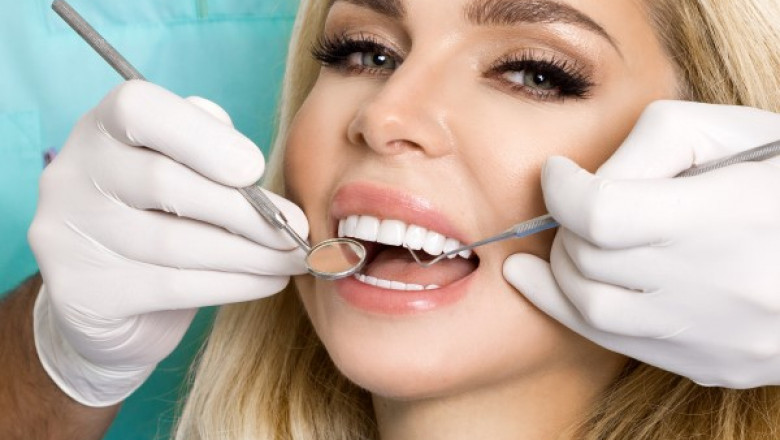 Why Should You Use Veneers?