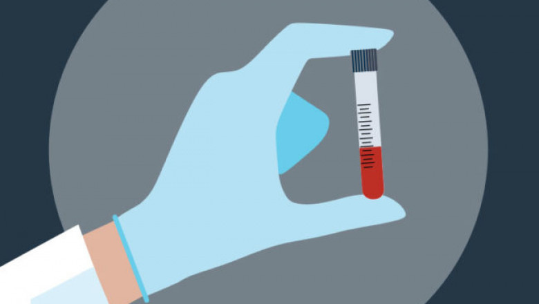 Cholesterol Screening Cholesterol Lab Testing Market: Analysis, Size, Share, Trends, and Forecast for 2022-2030