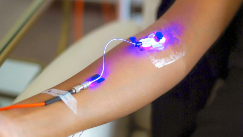 Global Blood Irradiation Market Report, Latest Trends, Industry Opportunity & Forecast to 2028