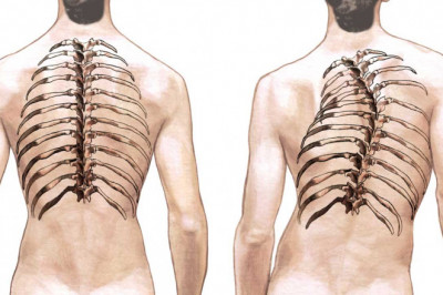 Global Adult Spinal Deformity Market Regional Insights
