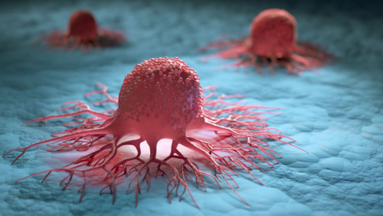 Natural Killer Cells Therapeutics Market 2022 Size, Key Players & Forecast Report to 2028