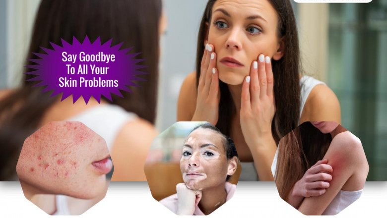 Top 5 tips to choose the best dermatologist in Bangalore