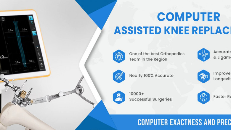 COMPUTER ASSISTED KNEE REPLACEMENT SURGERY
