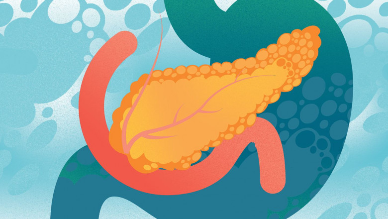 Exocrine Pancreatic Insufficiency (EPI) Therapeutics and Diagnostics Market – Historical factors Poised for Strong Growth Throughout The Forecast Period 2022 - 2028