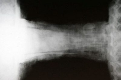 Heavily Decorated Viking Sword X-Rayed