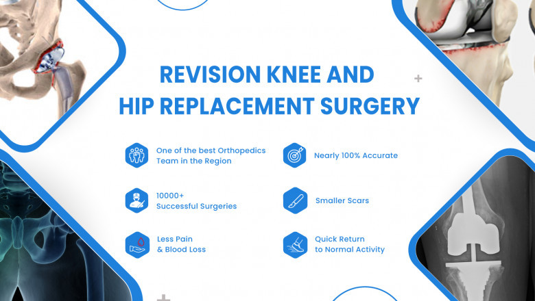 COMPUTER ASSISTED REVISION SURGERY