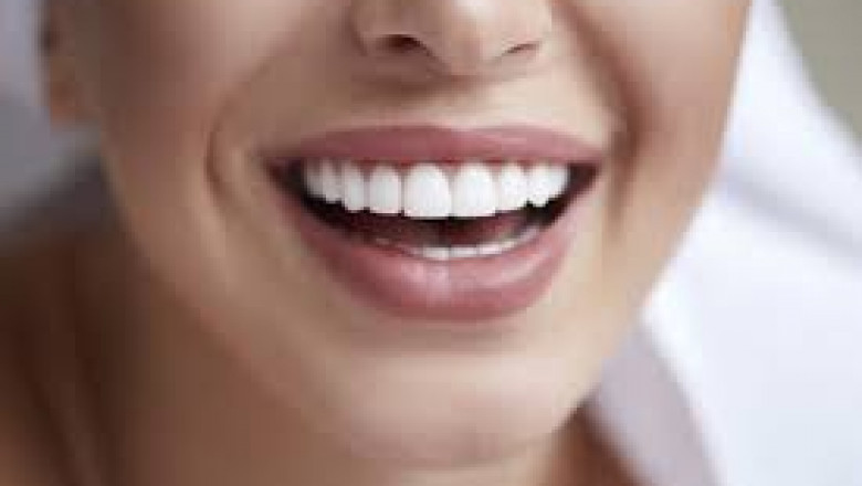 Dental Implants North Miami