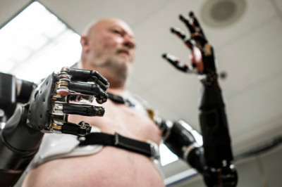 Global Medical Bionic Implants Market players