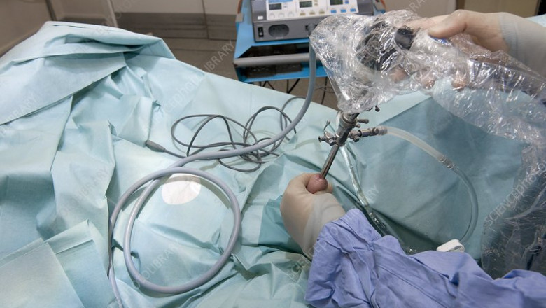 Global Peritoneoscopes Market Report, Latest Trends, Industry Opportunity & Forecast to 2028