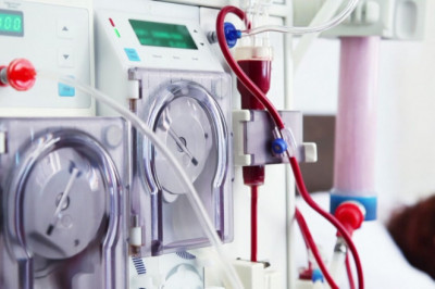 Kidney Dialysis Equipment Is Used When A Person’s Kidneys Are Impaired Beyond Any Feasible Treatment