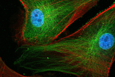 Neuro Microscopy Market Insights 2022, Global Analysis and Forecast to 2030