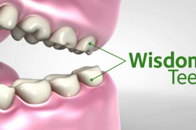 Wählen Sie den Spezialisten für die Entfernung