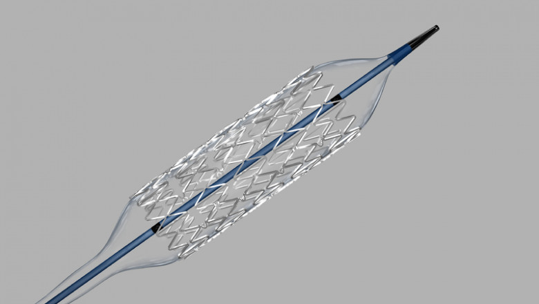 Balloon-Expandable Stents Market Size, Share, Trends | Forecast 2029