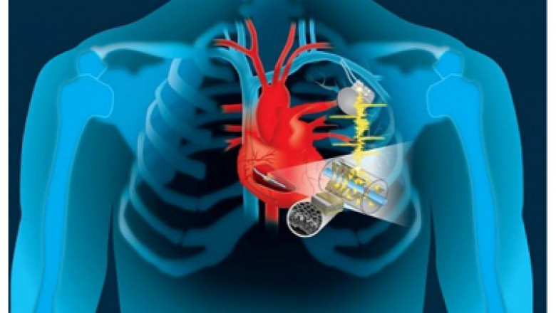 Structural Heart Devices Market Research Report: Size & Share, Key Players, Growth Strategies till 2028