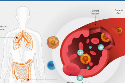 Cancer Protection is About Making Smart Decisions