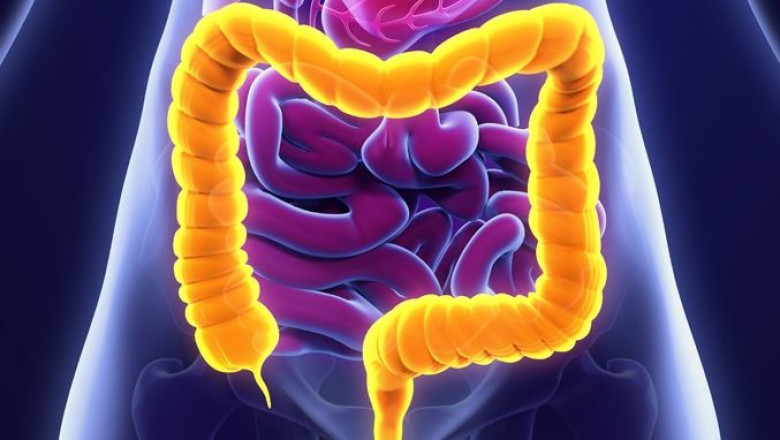 China Ulcerative Colitis Affects Both The Rectum And Colon's Inner Lining