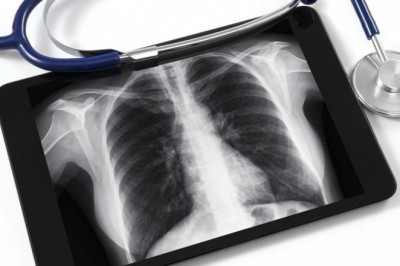 Pneumoconiosis Market Size, Share, Trends | Forecast 2029