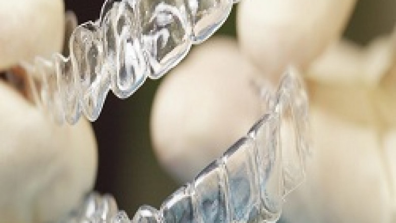 What Are the Natural Ways to Whiten Teeth?