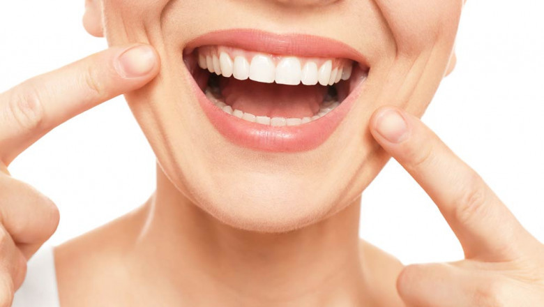 What Are The Various Types Of Braces To Straighten Your Teeth?