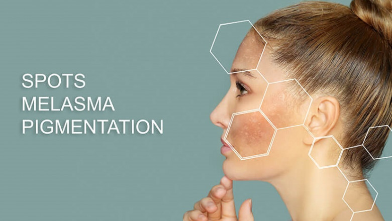 How Chemical Peels Function
