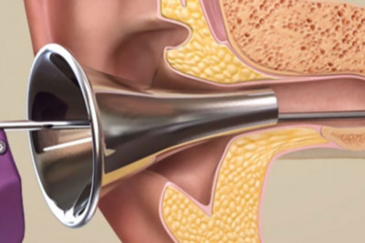 The Global Tympanostomy products Market is expected to grow due to an Increase in Ear Infections