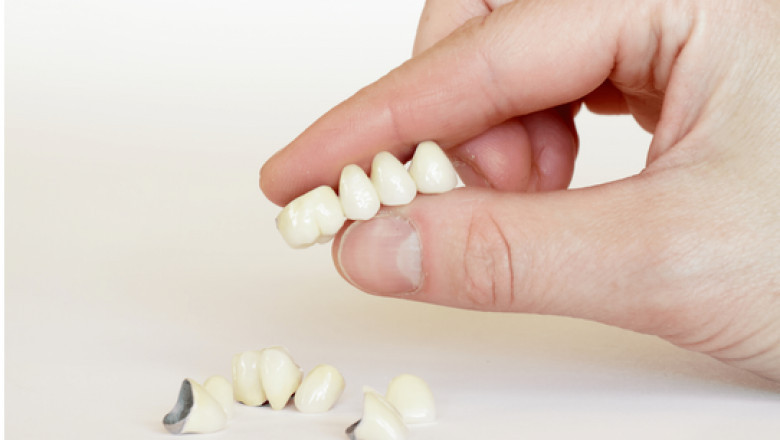 Tips on Finding the Best Oral Treatment Solutions