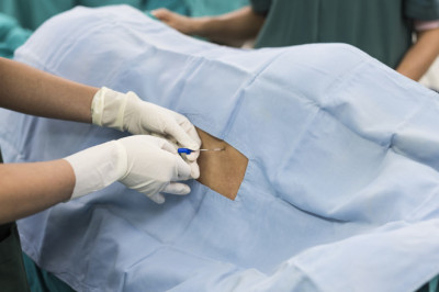 Brief about Epidural Anesthesia Disposable Devices